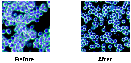 Vibranz ARC Vision Before and After Blood Results